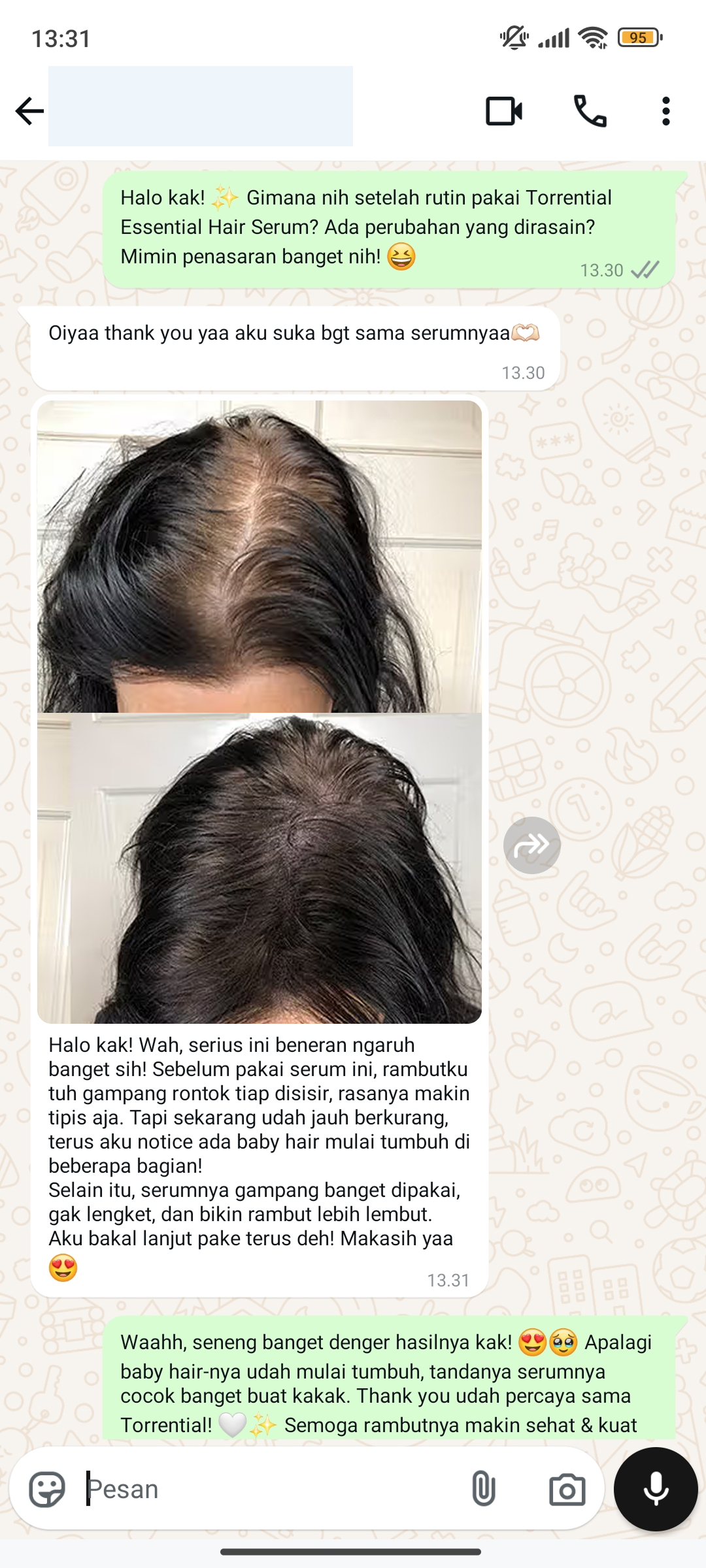 Testi Hair Serum Baru 04
